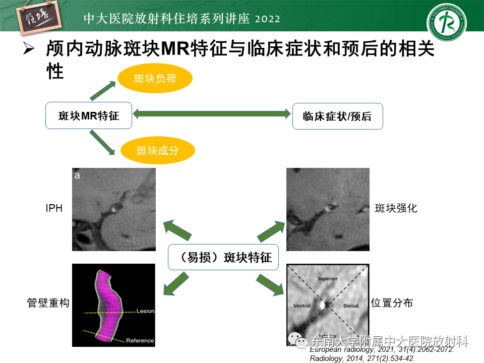 影像PPT - 【PPT】颅内MR血管壁成像技术与应用专家共识解读-39