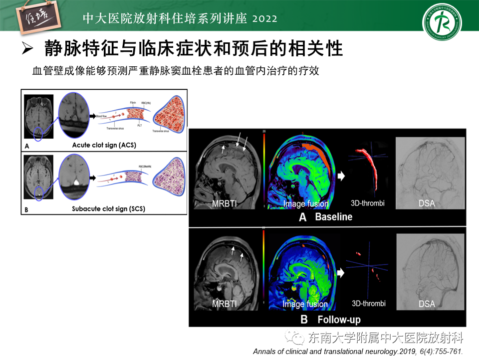 影像PPT - 【PPT】颅内MR血管壁成像技术与应用专家共识解读-42