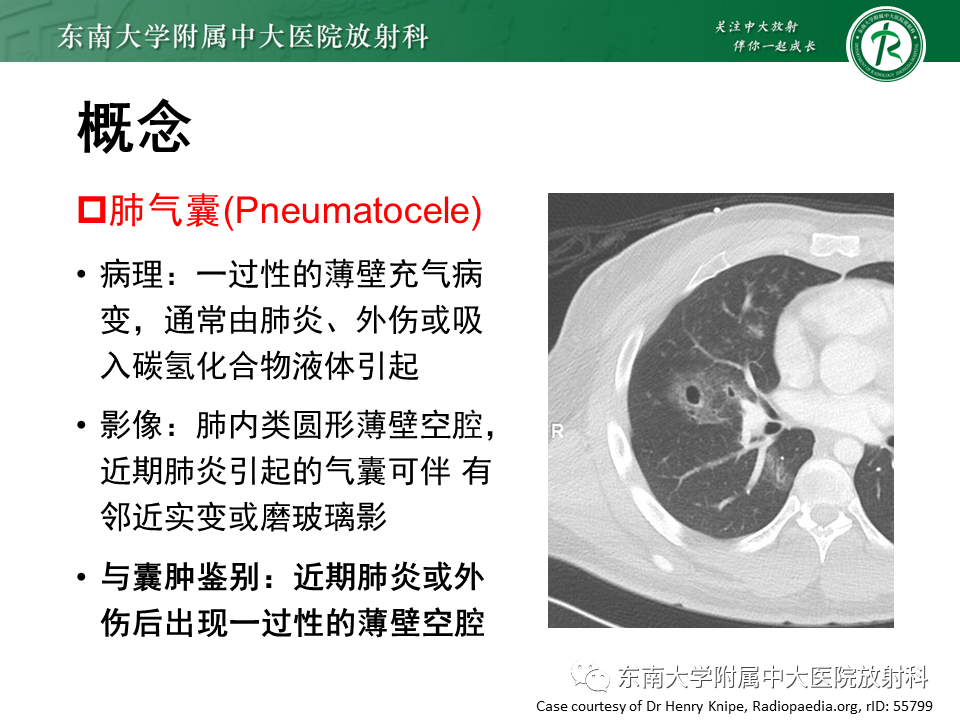 影像PPT - 【PPT】肺淋巴管肌瘤病-11