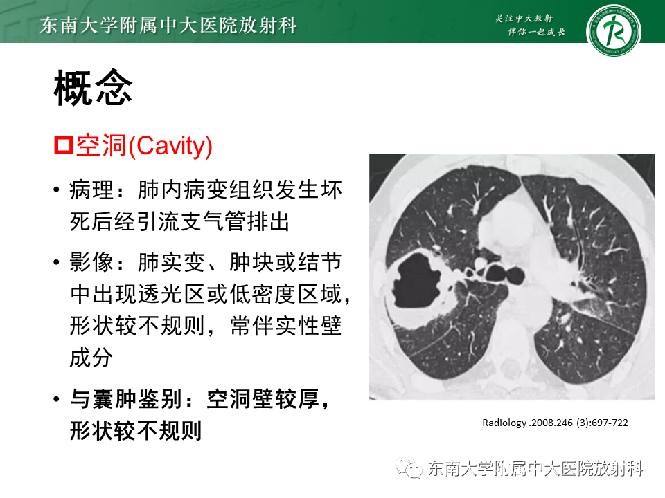 影像PPT - 【PPT】肺淋巴管肌瘤病-13