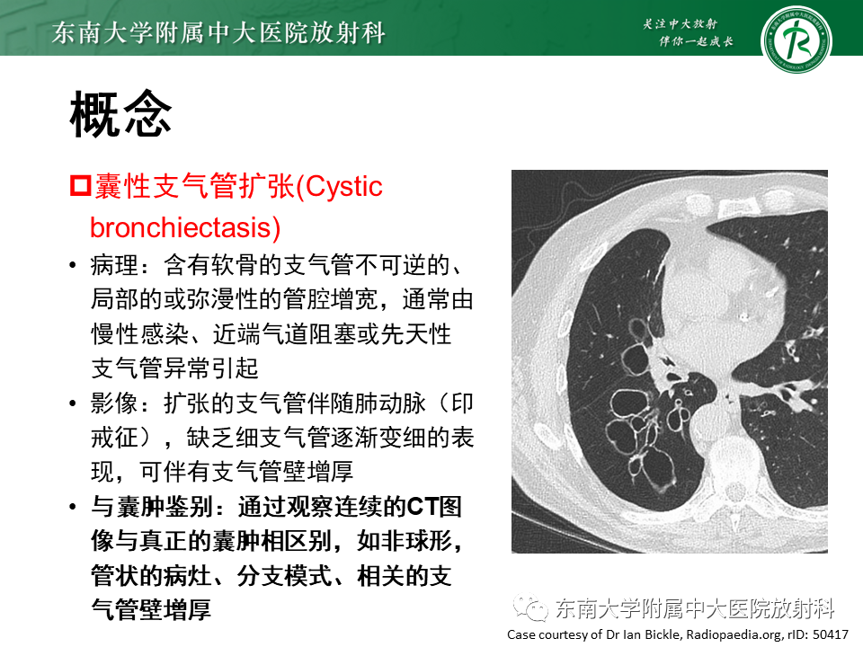 影像PPT - 【PPT】肺淋巴管肌瘤病-12