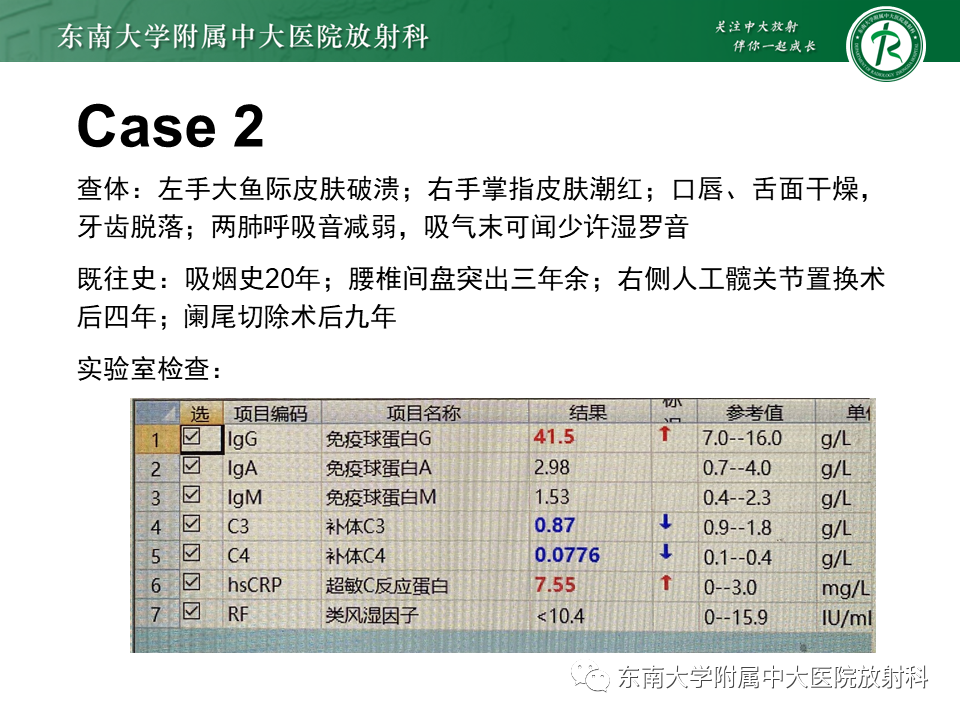 影像PPT - 【PPT】肺淋巴管肌瘤病-37