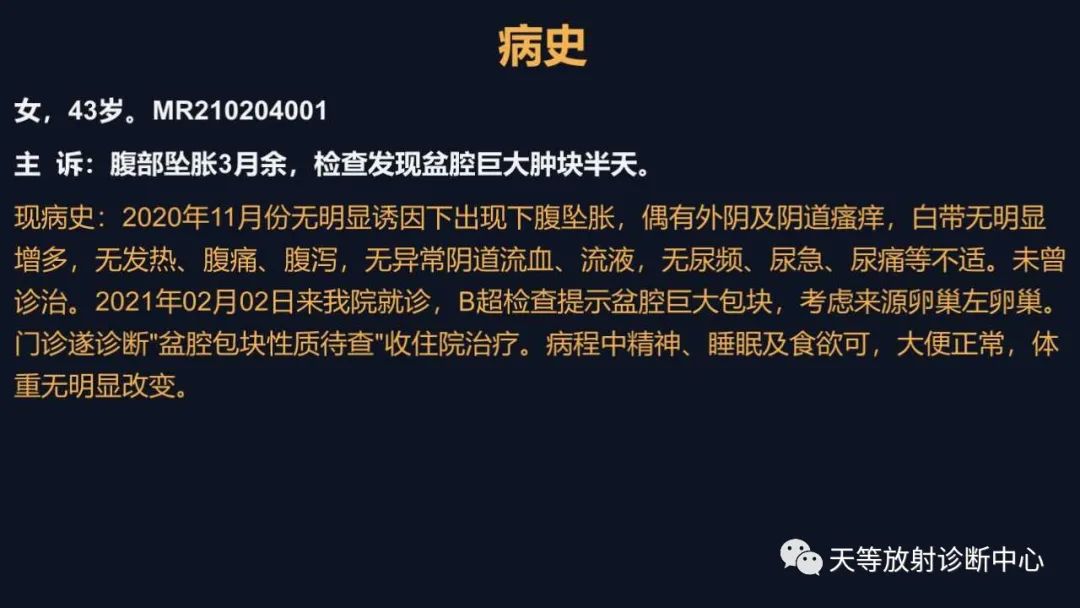 影像PPT - 【病例】卵巢囊腺瘤1例MR影像-1 影像PPT - 【病例】卵巢囊腺瘤1例MR影像-1