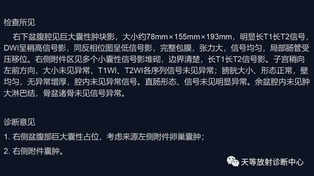 影像PPT - 【病例】卵巢囊腺瘤1例MR影像-14 影像PPT - 【病例】卵巢囊腺瘤1例MR影像-14