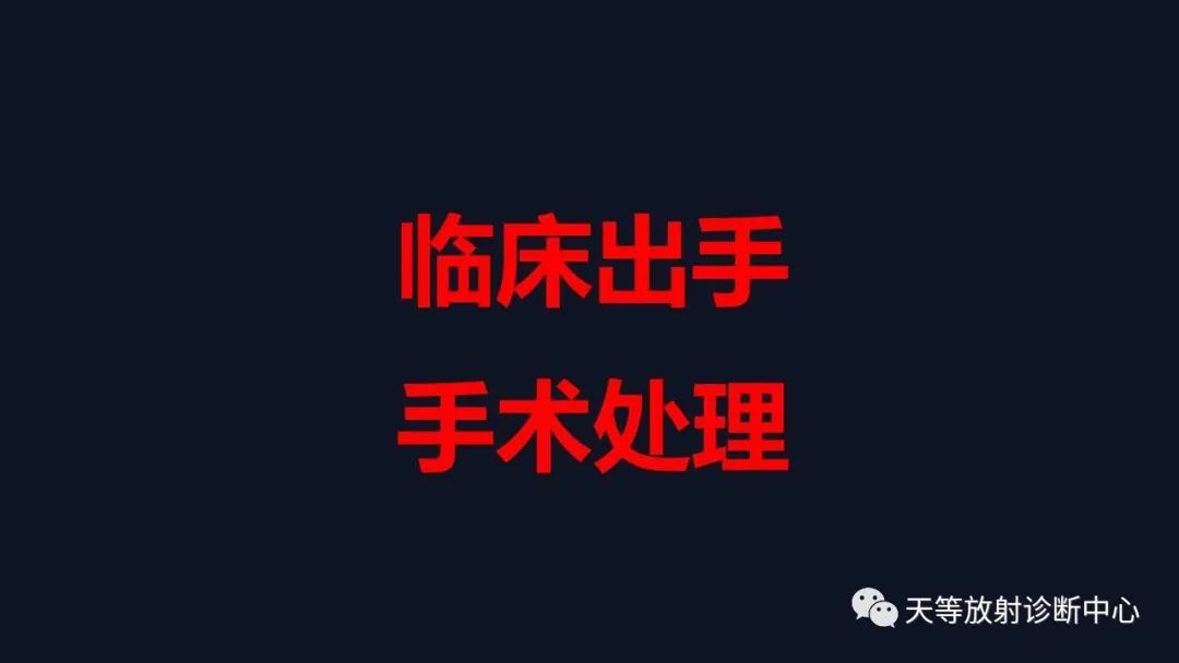 影像PPT - 【病例】卵巢囊腺瘤1例MR影像-16 影像PPT - 【病例】卵巢囊腺瘤1例MR影像-16
