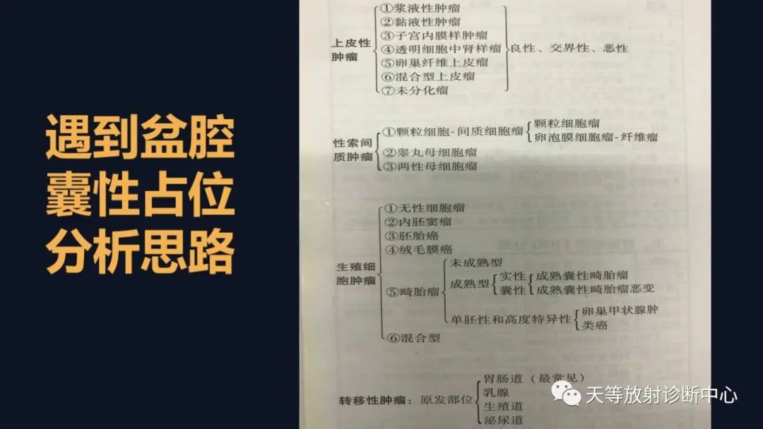 影像PPT - 【病例】卵巢囊腺瘤1例MR影像-45 影像PPT - 【病例】卵巢囊腺瘤1例MR影像-45