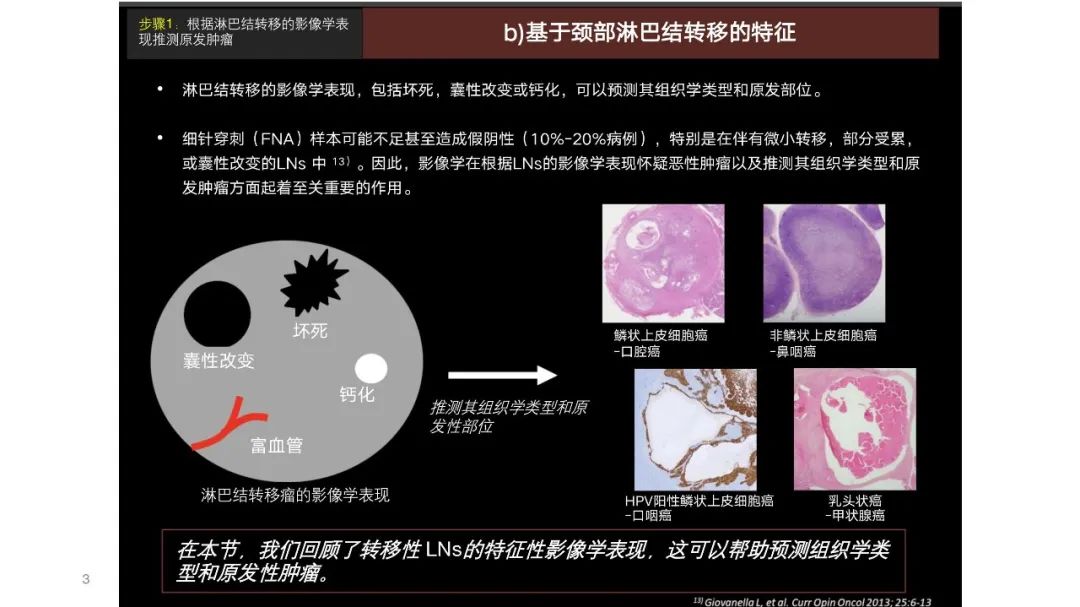 影像PPT - 【PPT】原发肿瘤在哪里？不明原发肿瘤颈部淋巴结转移的影像学检查方法-1