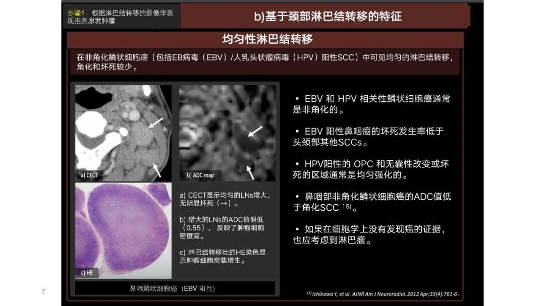 影像PPT - 【PPT】原发肿瘤在哪里？不明原发肿瘤颈部淋巴结转移的影像学检查方法-5