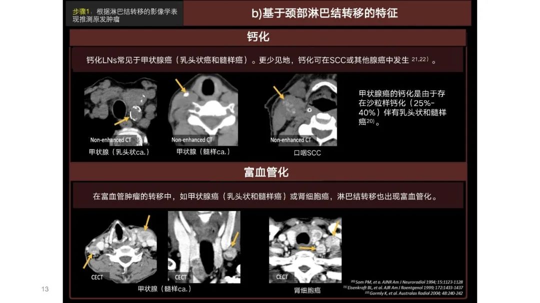 影像PPT - 【PPT】原发肿瘤在哪里？不明原发肿瘤颈部淋巴结转移的影像学检查方法-11