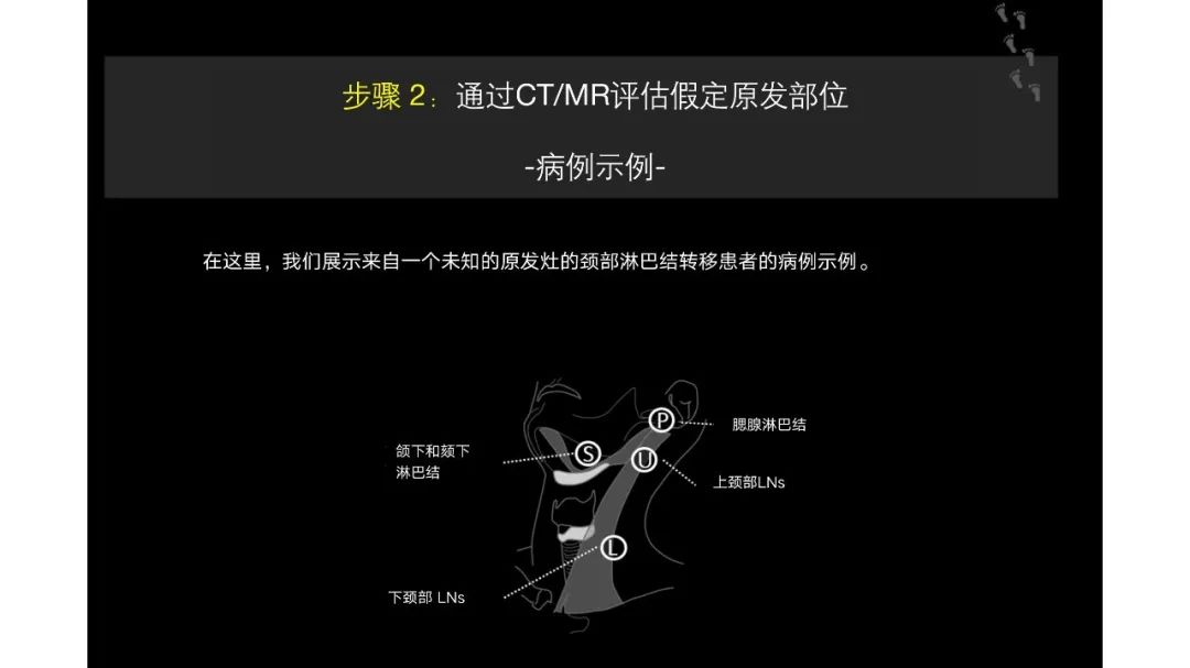 影像PPT - 【PPT】原发肿瘤在哪里？不明原发肿瘤颈部淋巴结转移的影像学检查方法-13