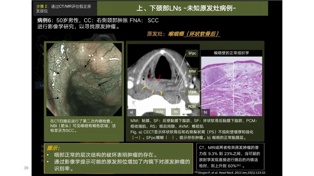影像PPT - 【PPT】原发肿瘤在哪里？不明原发肿瘤颈部淋巴结转移的影像学检查方法-37