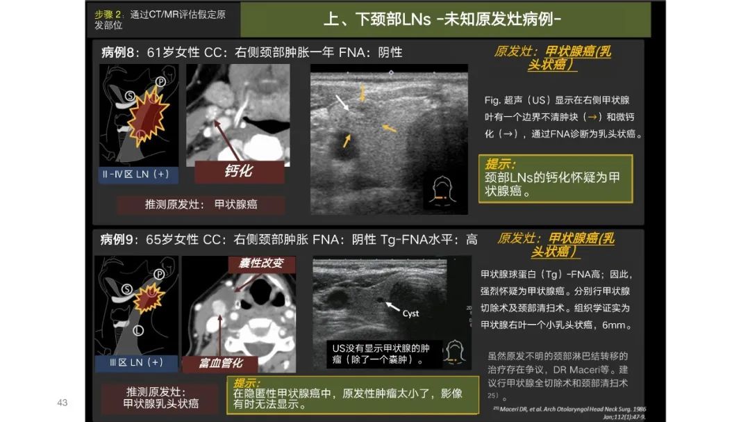 影像PPT - 【PPT】原发肿瘤在哪里？不明原发肿瘤颈部淋巴结转移的影像学检查方法-41