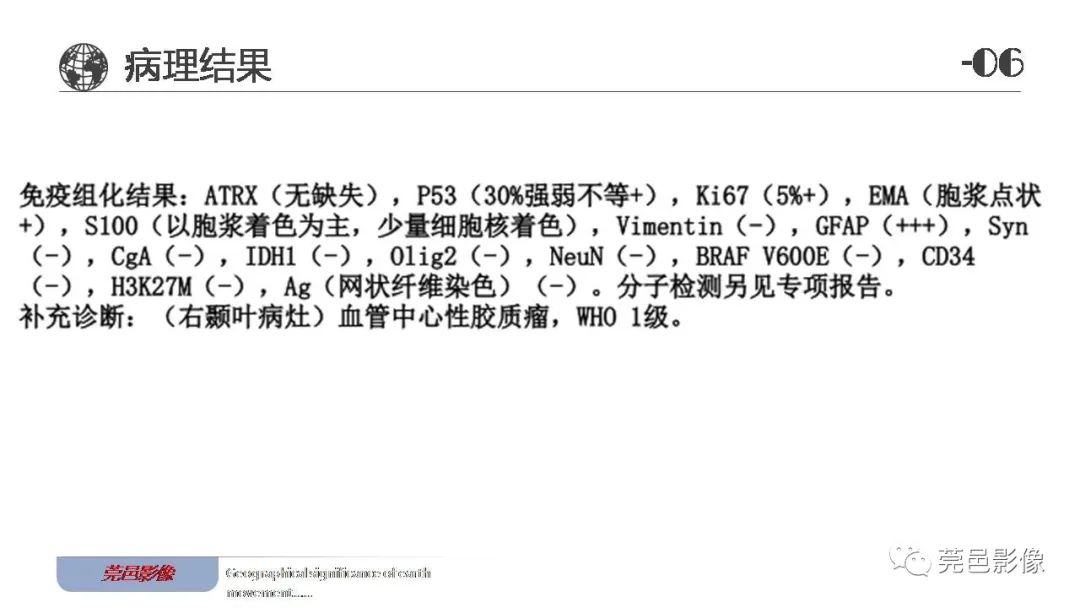 影像PPT - 【病例】血管中心性胶质瘤一例分析-24