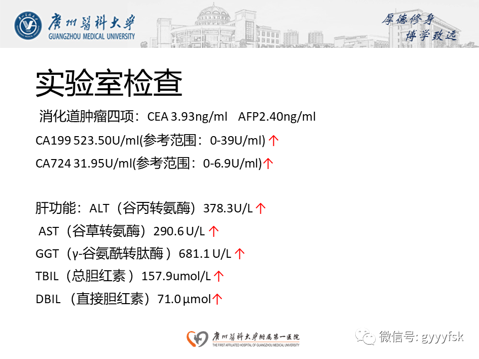 影像PPT - 【PPT】胆管导管内乳头状肿瘤(IPNB)-3
