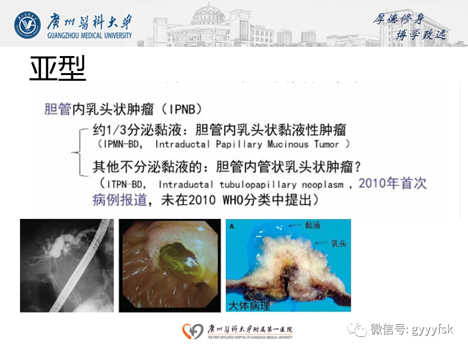 影像PPT - 【PPT】胆管导管内乳头状肿瘤(IPNB)-11