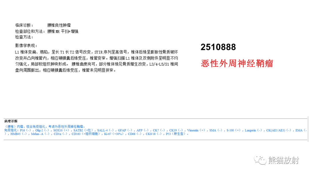 影像PPT - 【病例】椎体恶性外周神经鞘瘤 VS 浆细胞瘤-11
