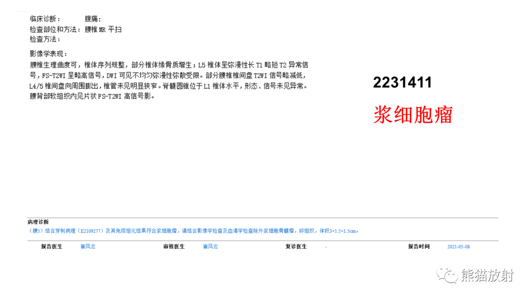 影像PPT - 【病例】椎体恶性外周神经鞘瘤 VS 浆细胞瘤-12