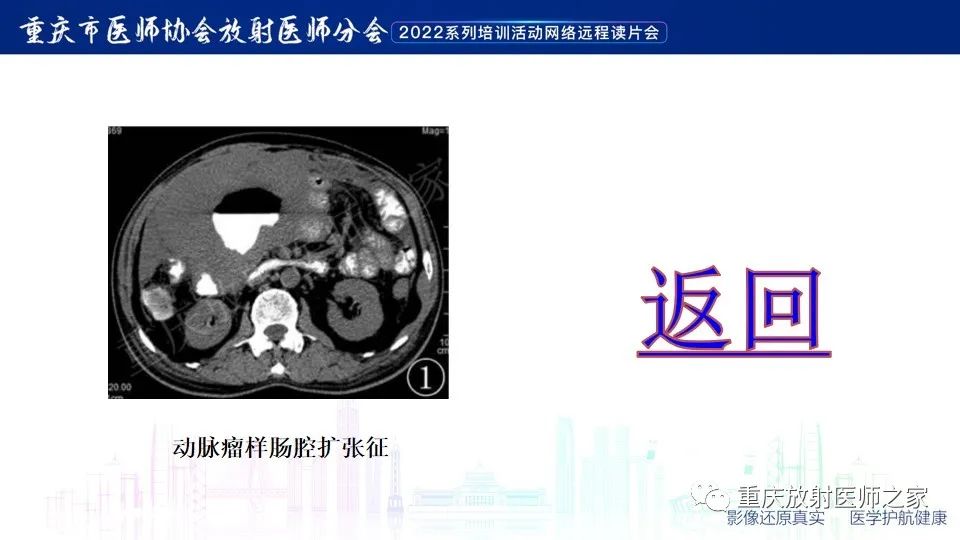 影像PPT - 【病例】小肠胃肠道间质瘤1例CT影像-26