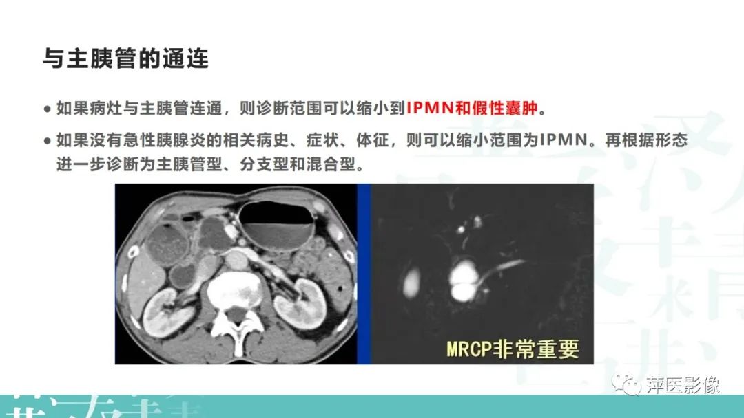 影像PPT - 【PPT】胰腺囊性肿瘤中的“老爷子”（IPMN）及诊断思路-17