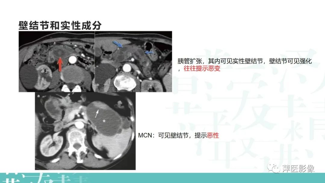 影像PPT - 【PPT】胰腺囊性肿瘤中的“老爷子”（IPMN）及诊断思路-31