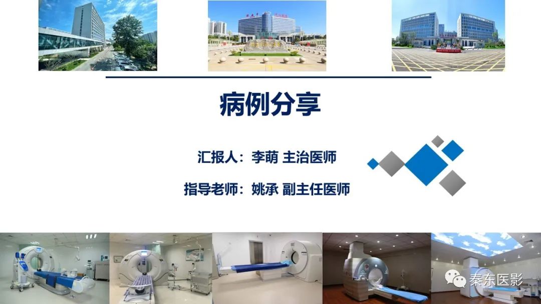 影像PPT - 【PPT】“大”有不同—缺血性脑卒中和卒中样发作病变的影像学诊断-1