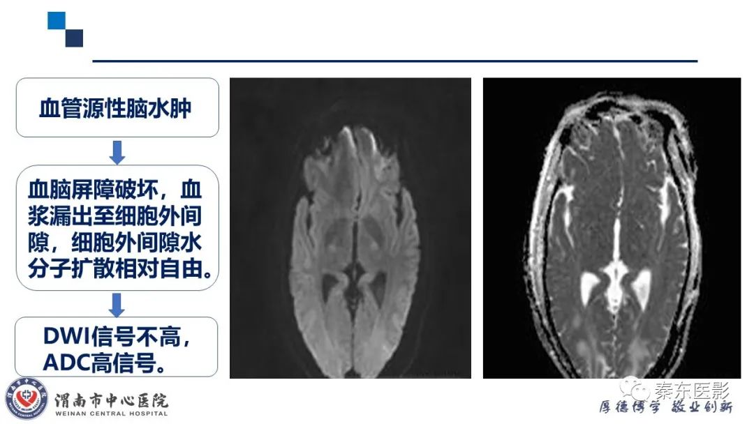 影像PPT - 【PPT】“大”有不同—缺血性脑卒中和卒中样发作病变的影像学诊断-22