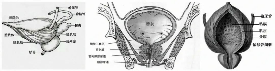 影像PPT - 膀胱MRI扫描-1 影像PPT - 膀胱MRI扫描-1