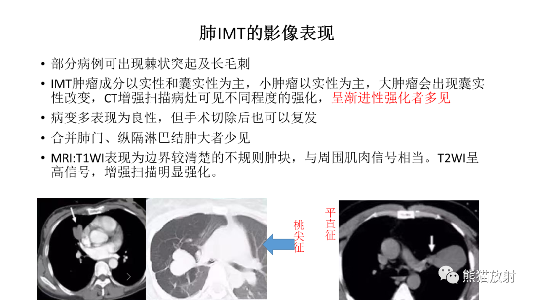 影像PPT - 【病例】肺腺癌 VS 炎性肌纤维母细胞瘤-23