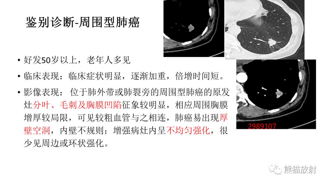 影像PPT - 【病例】肺腺癌 VS 炎性肌纤维母细胞瘤-27