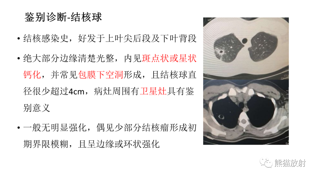 影像PPT - 【病例】肺腺癌 VS 炎性肌纤维母细胞瘤-29