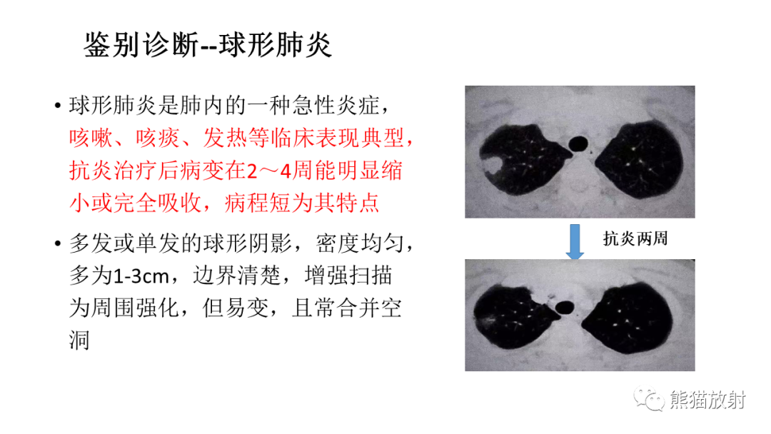 影像PPT - 【病例】肺腺癌 VS 炎性肌纤维母细胞瘤-32