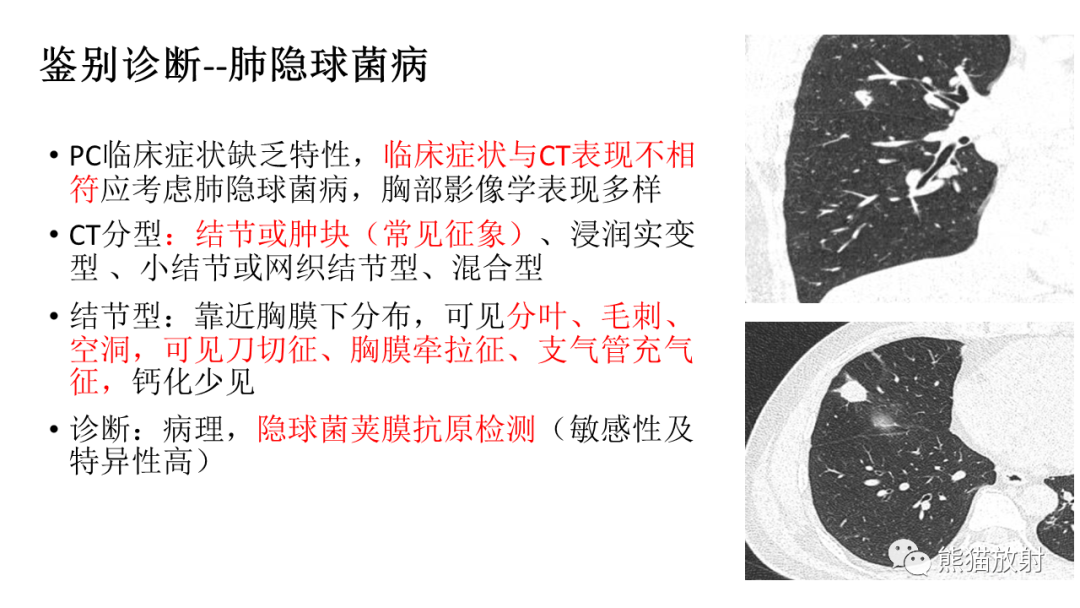 影像PPT - 【病例】肺腺癌 VS 炎性肌纤维母细胞瘤-33