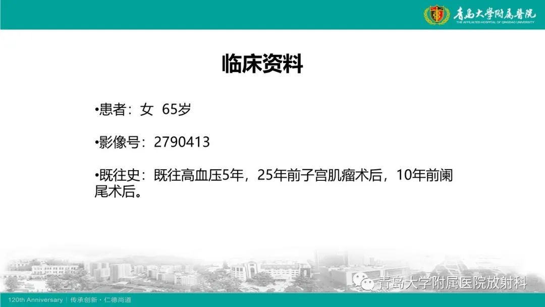 影像PPT - 【病例】Wernicke脑病1例MR影像-2