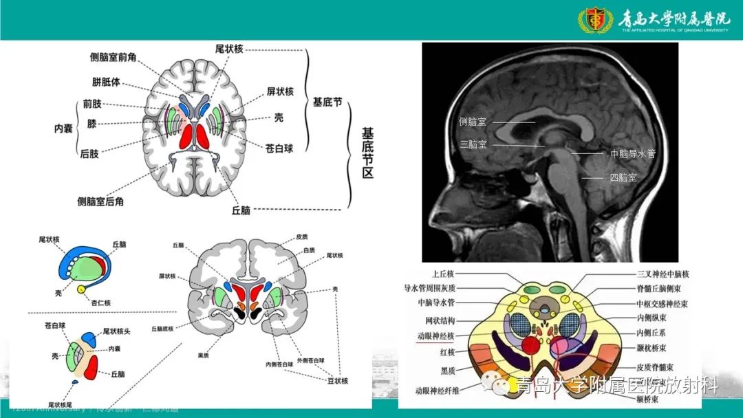 影像PPT - 【病例】Wernicke脑病1例MR影像-10