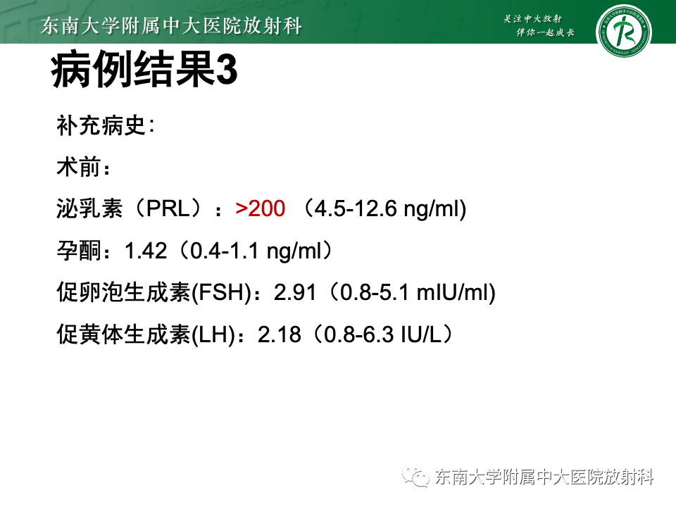 影像PPT - 【PPT】斜坡骨质破坏性病变影像诊断-15