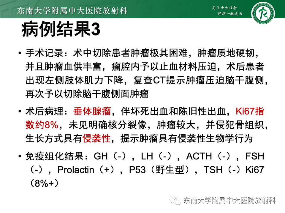 影像PPT - 【PPT】斜坡骨质破坏性病变影像诊断-16