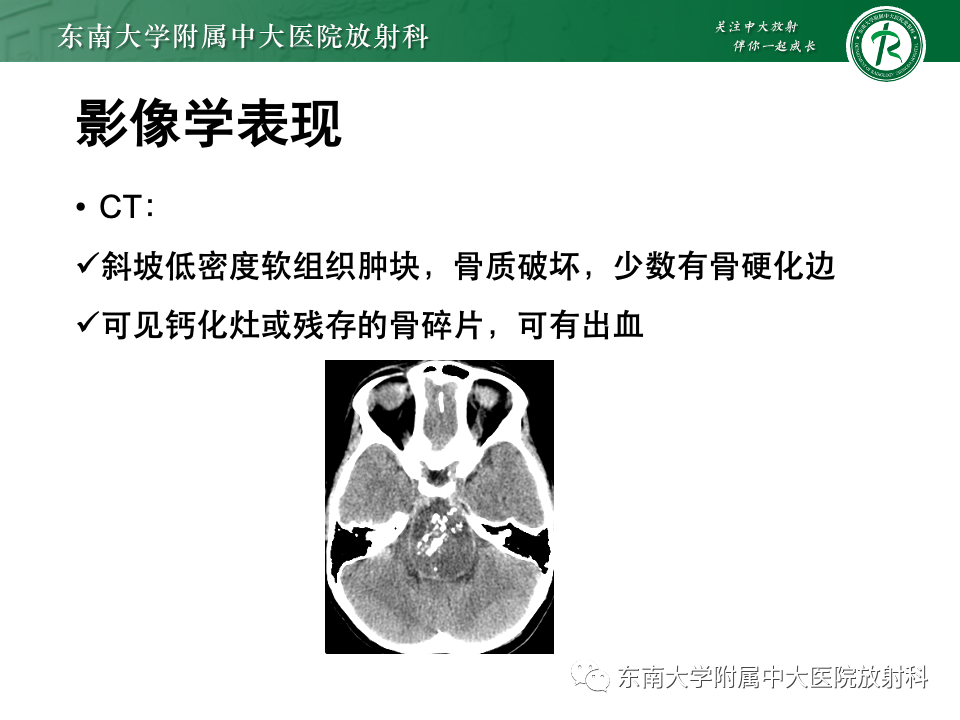 影像PPT - 【PPT】斜坡骨质破坏性病变影像诊断-26