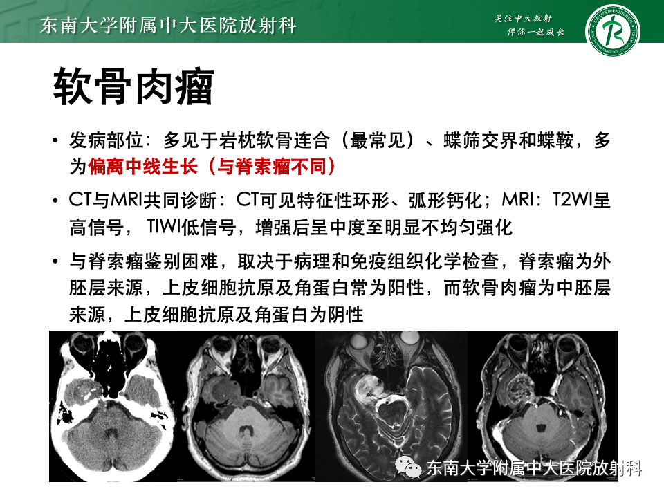 影像PPT - 【PPT】斜坡骨质破坏性病变影像诊断-31