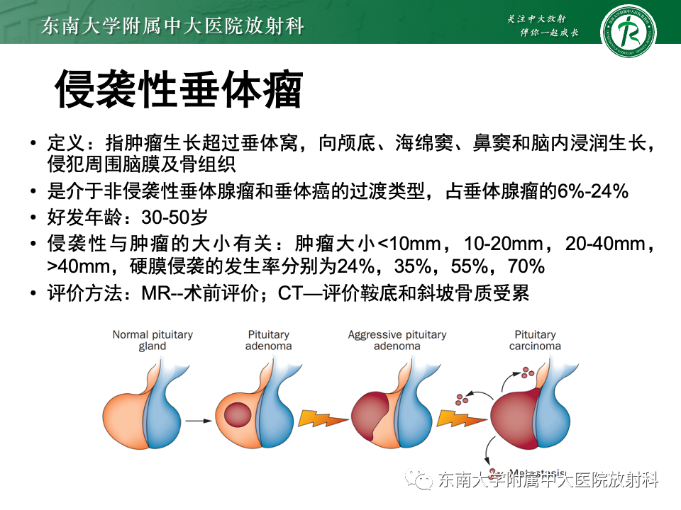 影像PPT - 【PPT】斜坡骨质破坏性病变影像诊断-35