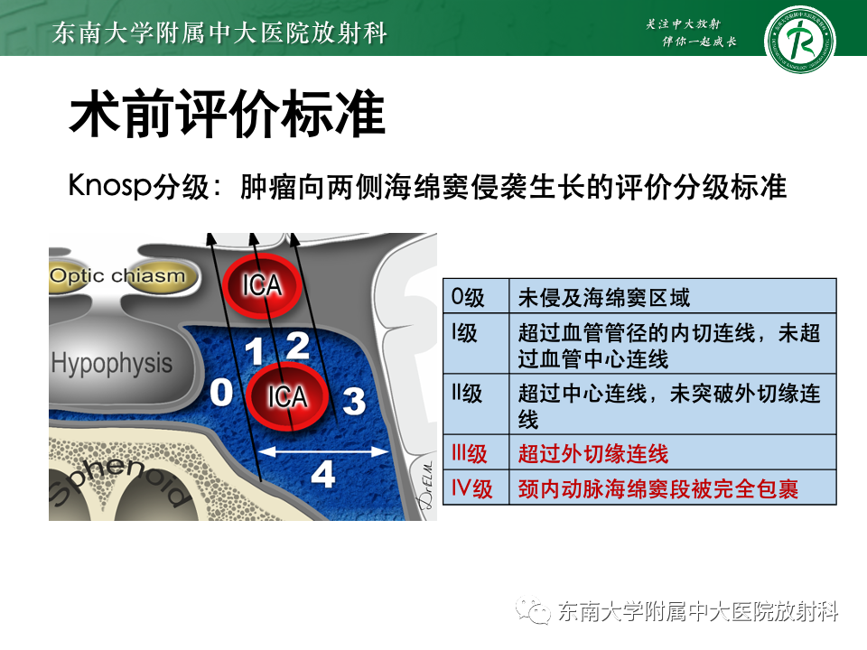 影像PPT - 【PPT】斜坡骨质破坏性病变影像诊断-36