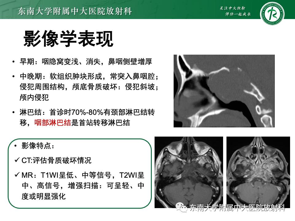 影像PPT - 【PPT】斜坡骨质破坏性病变影像诊断-41