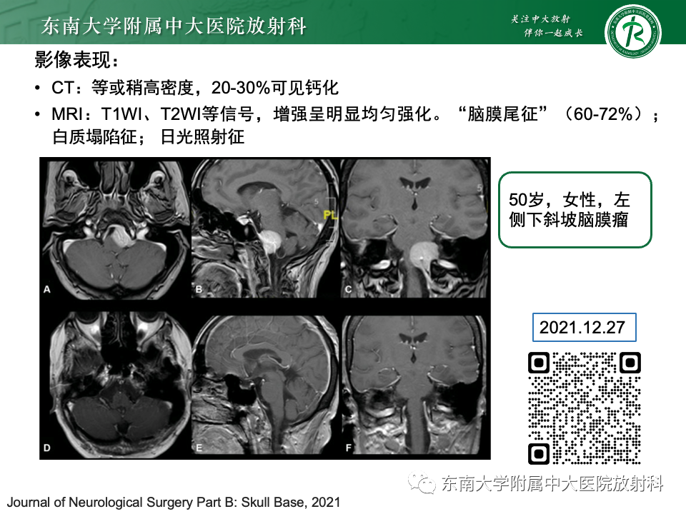 影像PPT - 【PPT】斜坡骨质破坏性病变影像诊断-47