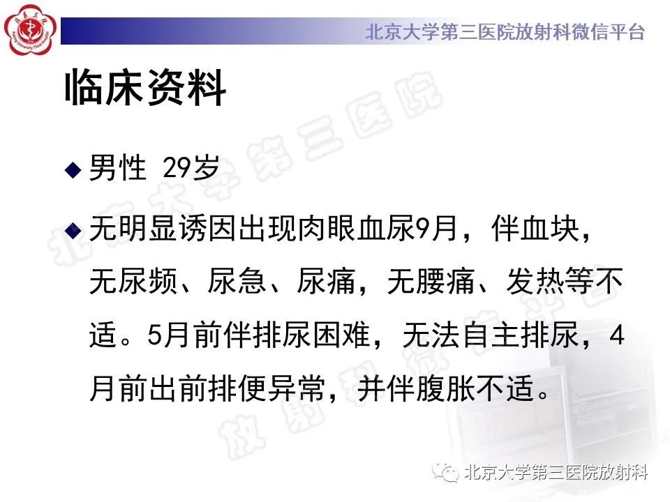 影像PPT - 【PPT】前列腺肉瘤-2