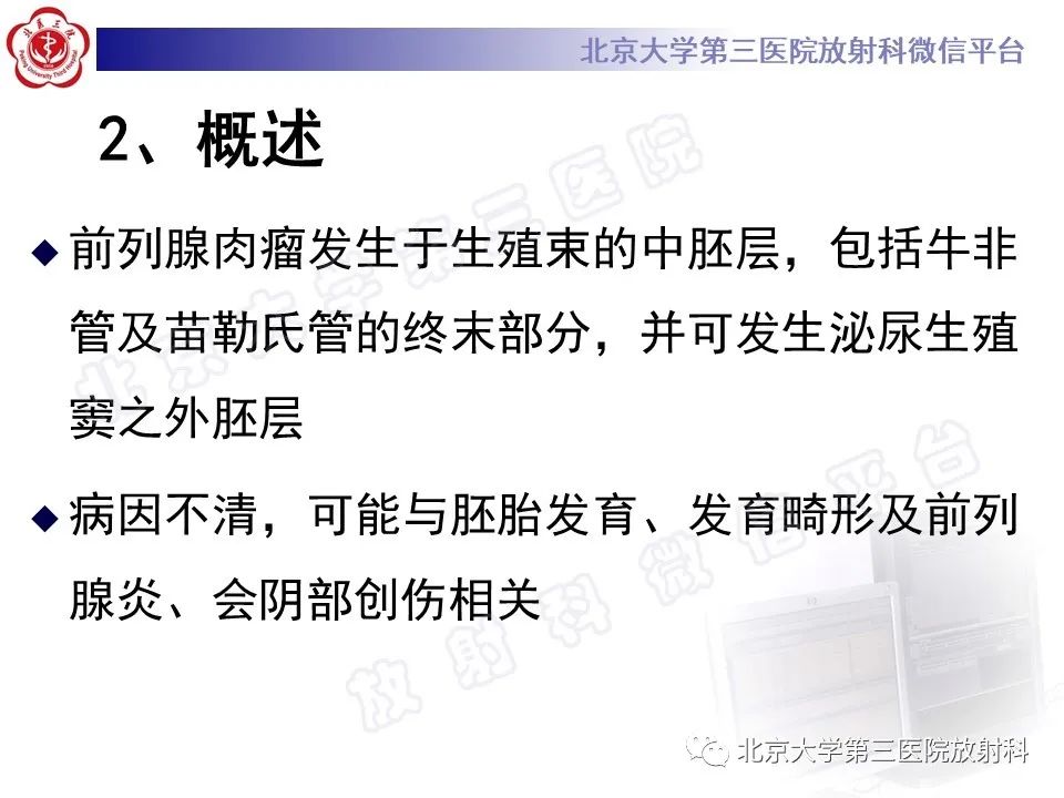 影像PPT - 【PPT】前列腺肉瘤-16
