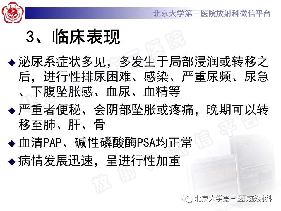 影像PPT - 【PPT】前列腺肉瘤-17
