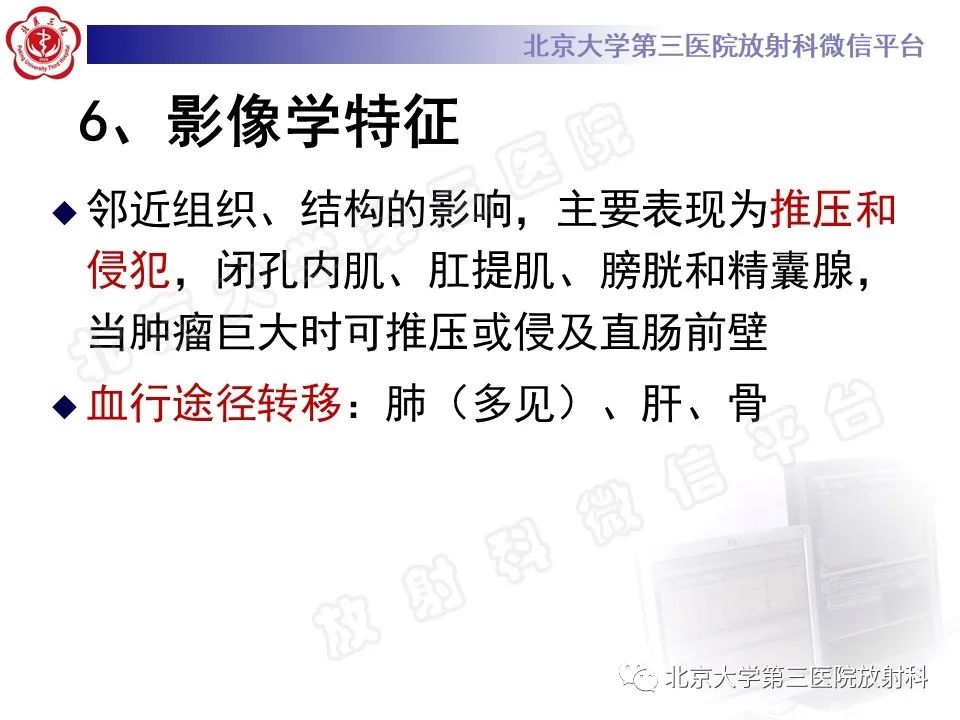 影像PPT - 【PPT】前列腺肉瘤-21