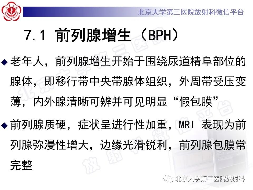 影像PPT - 【PPT】前列腺肉瘤-25