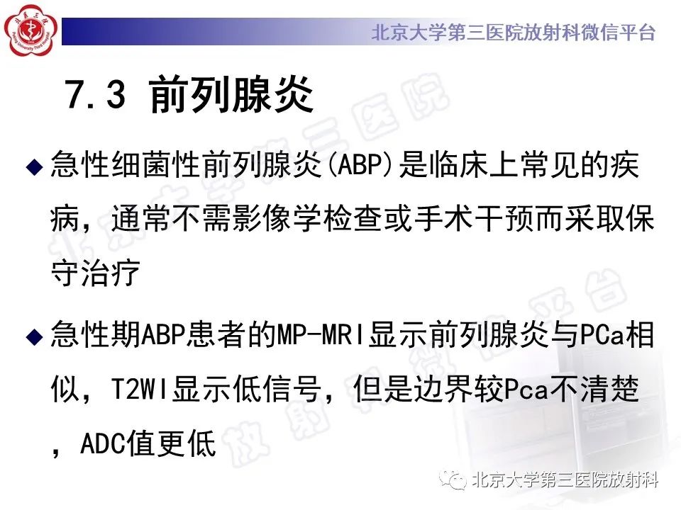 影像PPT - 【PPT】前列腺肉瘤-31