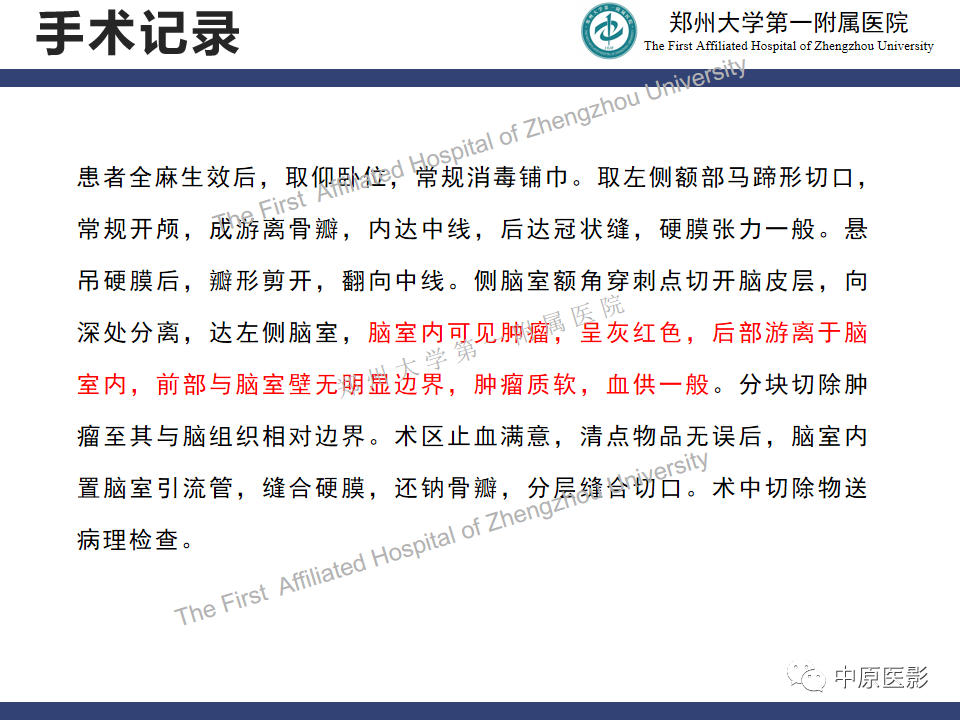 影像PPT - 【病例】室管膜下巨细胞星形细胞瘤1例MR影像-8
