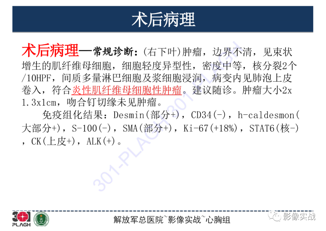影像PPT - 【病例】肺炎性肌纤维母细胞瘤1例CT影像-21
